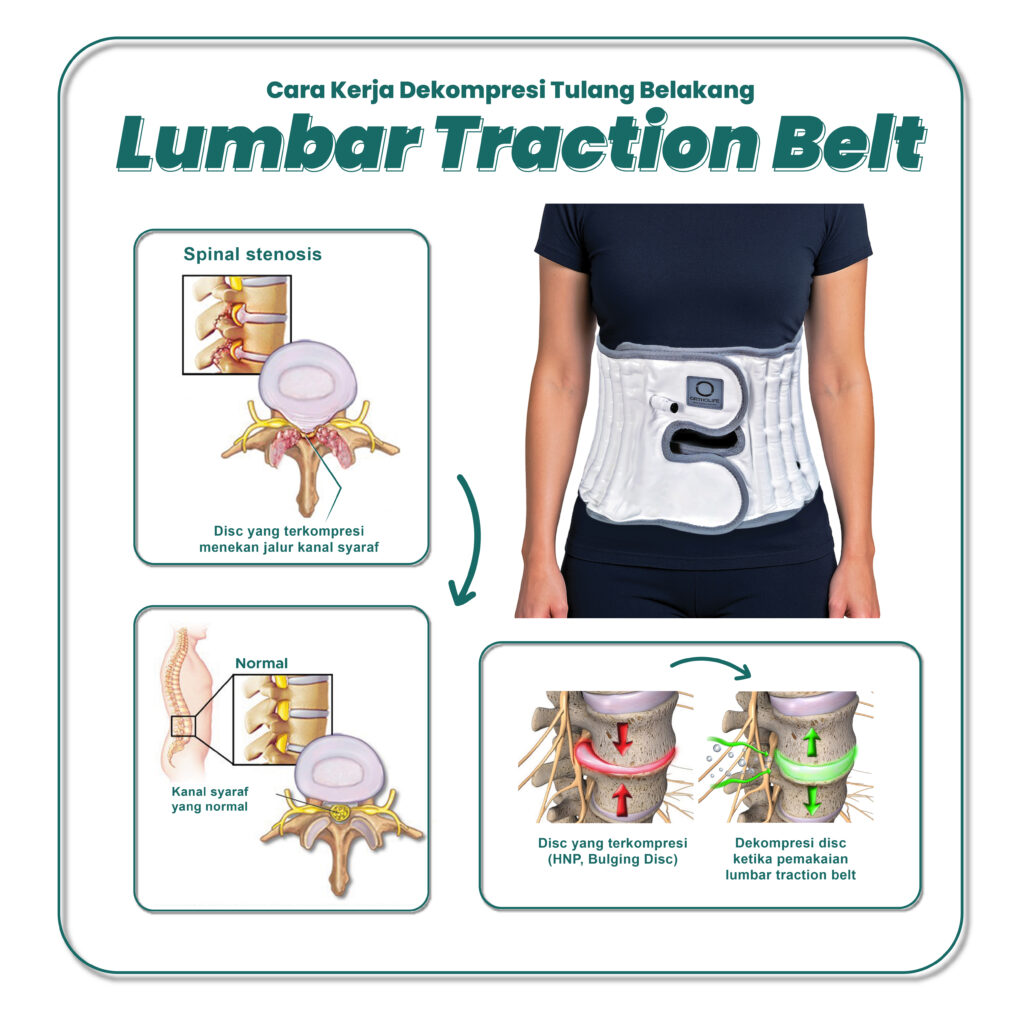 Cara Kerja Alat Lumbar Traction Belt
